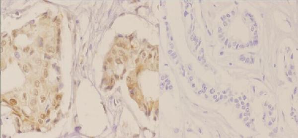 a00173t187 cdkn1b primary antiboties ihc testing 2