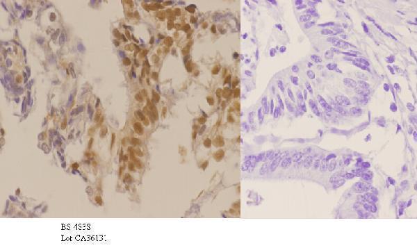 a00173t187 cdkn1b primary antiboties ihc testing 3
