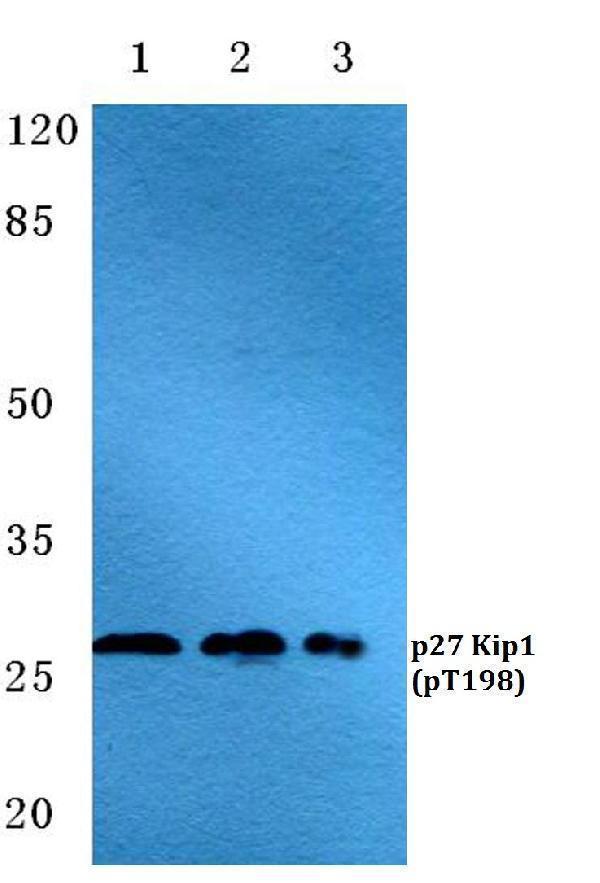 a00173t198 cdkn1b primary antiboties wb testing 1
