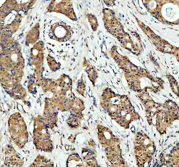  IHC analysis of p38 alpha/MAPK14 using anti-p38 alpha/MAPK14 antibody (A00176-2)