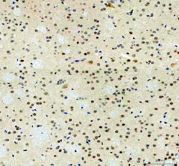 a00176 2 mapk14 primary antibodies ihc testing 3