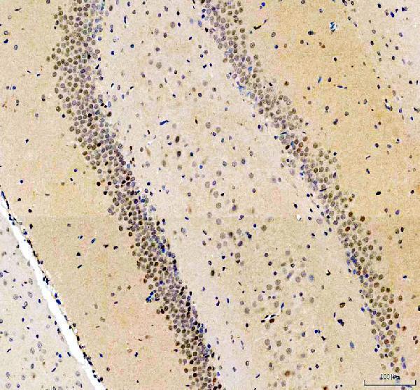 a00176 2 mapk14 primary antibodies ihc testing 4