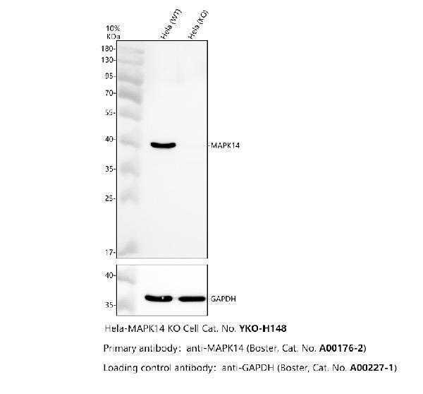 Western blot analysis of p38 MAPK/MAPK14 using anti-p38 MAPK/MAPK14 antibody (A00176-2)