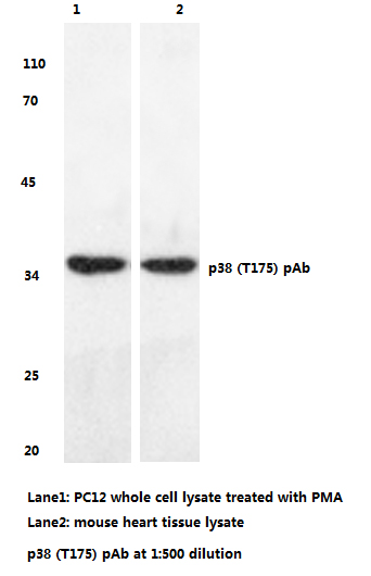 Western blot (WB) analyzes of p38 (T175) pAb