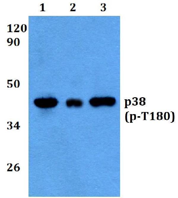 Western blot (WB) analysis of p-p38 (T180) polyclonal antibody at 1:500 dilution
Lane1:HEK293T cell lysate treated with UV(4h)
Lane2:Raw264