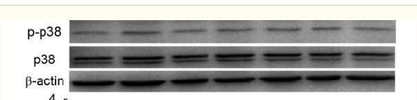 Immunohistochemical analysis of paraffin-embedded Human-lung tissue