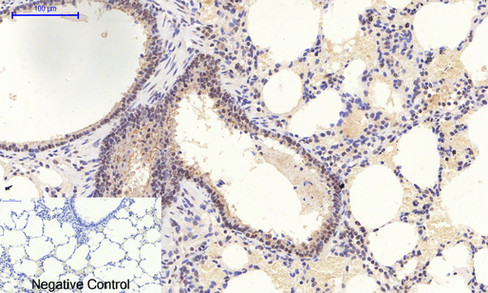 a00176t180y182 mapk14 primary antibodies ihc testing 5