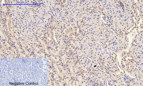 a00176t180y182 mapk14 primary antibodies ihc testing 6