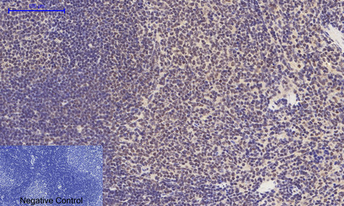 a00176t180y182 mapk14 primary antibodies ihc testing 7