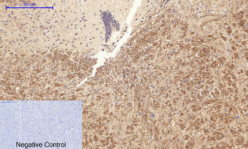 a00176t180y182 mapk14 primary antibodies ihc testing 9