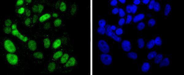 ICC staining SOX9 in MCF-7 cells (green)