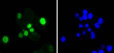 ICC staining SOX9 in SW480 cells (green)