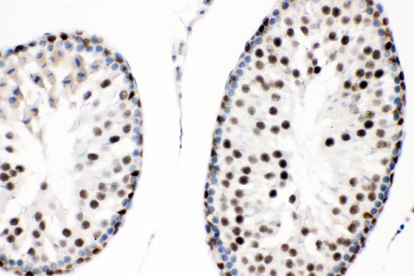 a00177 2 sox9 primary antibodies ihc testing 5