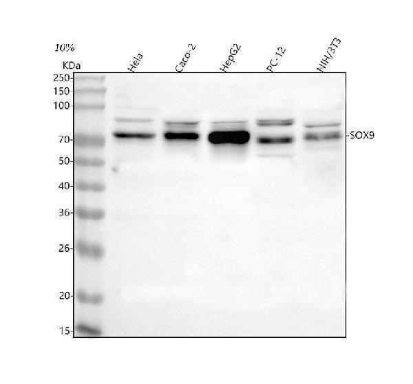  Western blot analysis of SOX9 using anti-SOX9 antibody (A00177-3)