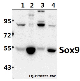 Western blot (WB) analysis of Sox9 (Q175) polyclonal antibody at 1:500 dilution
Lane1:C6 whole cell lysate(40ug)
Lane2:BV2 whole cell lysate(40ug)
Lane3:Hela whole cell lysate(40ug)
Lane4:Panc1 whole cell lysate(40ug)