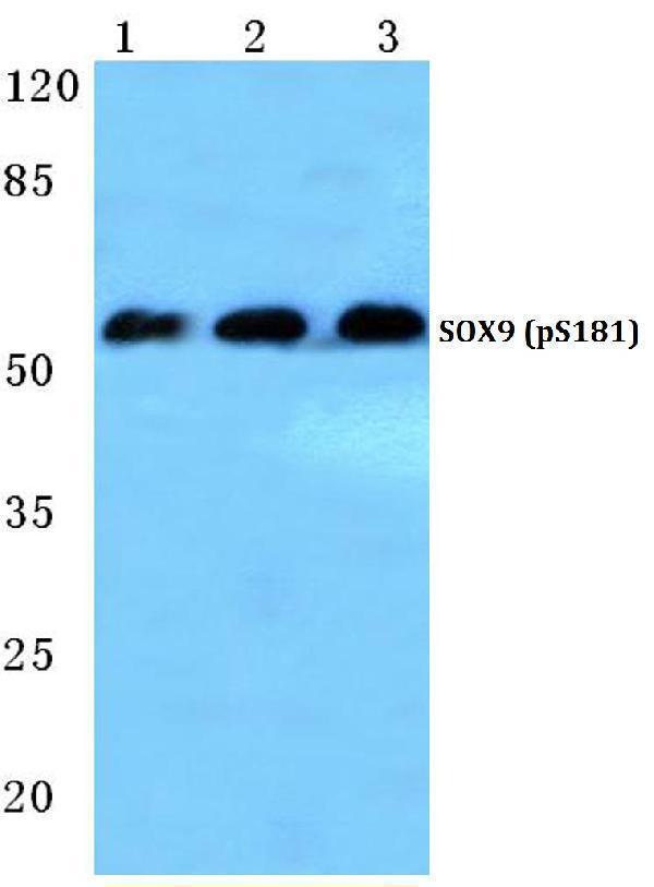Western blot (WB) analysis of p-SOX9 (S181) polyclonal antibody at 1:500 dilution
Lane1:Hela lysate treated with PMA(100nM,30min)
Lane2:Mouse brain tissue lysate
Lane3:Rat liver tissue lysate