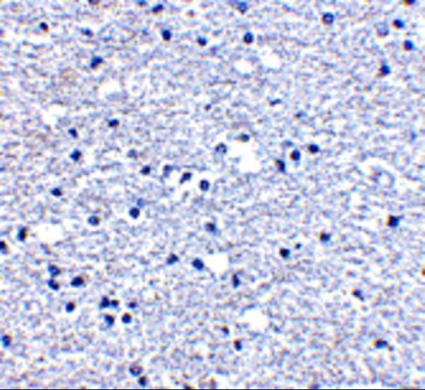 Immunohistochemistry of PD-1 in human brain tissue with PD-1 antibody at 5 μg/mL