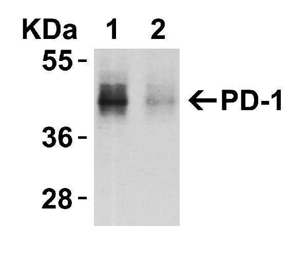 KD Validation in HeLa Cells 
Loading: 10 μg of HeLa WT cell lysates or PD-1 KD cell lysates