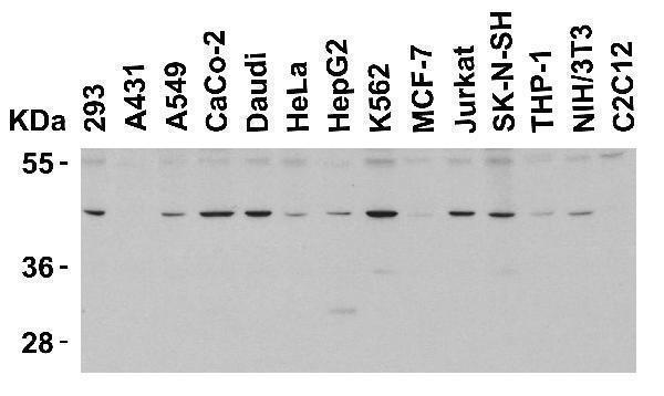 Western Blot Validation in Human and Mouse Cell Lines
Loading: 15 μg of lysates per lane