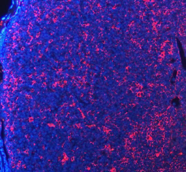 a00178 pdcd1 primary antibodies if testing 5