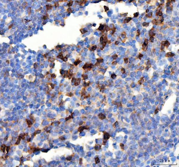  IHC analysis of PDCD1 using anti PDCD1 antibody (A00178)