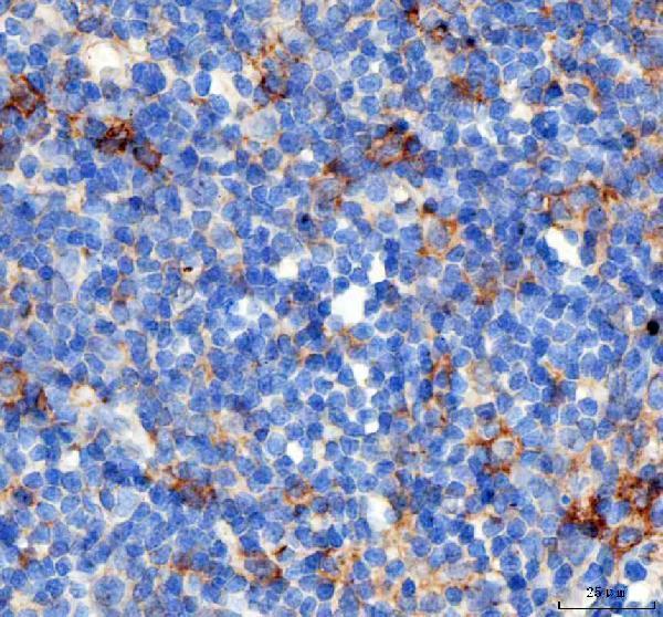 a00178 pdcd1 primary antibodies ihc testing 3_1