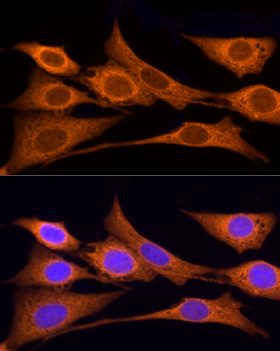 a00180 ids primary antiboties if testing 4