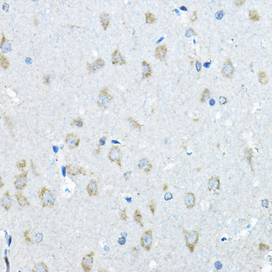 a00180 ids primary antiboties ihc testing 2