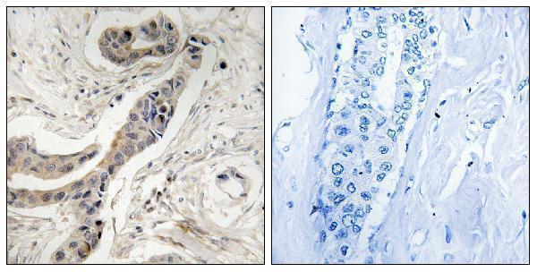a00181t115 bcl2l1 primary antibodies ihc testing 2