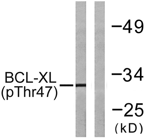 Western blot analysis of lysates from 293 cells treated with UV 30