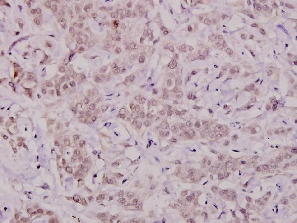 a00181t47 bcl2l1 primary antiboties ihc testing 2