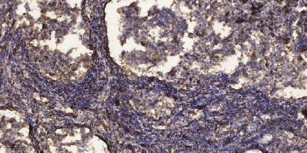 a00182s137 plk1 primary antibodies ihc testing 3