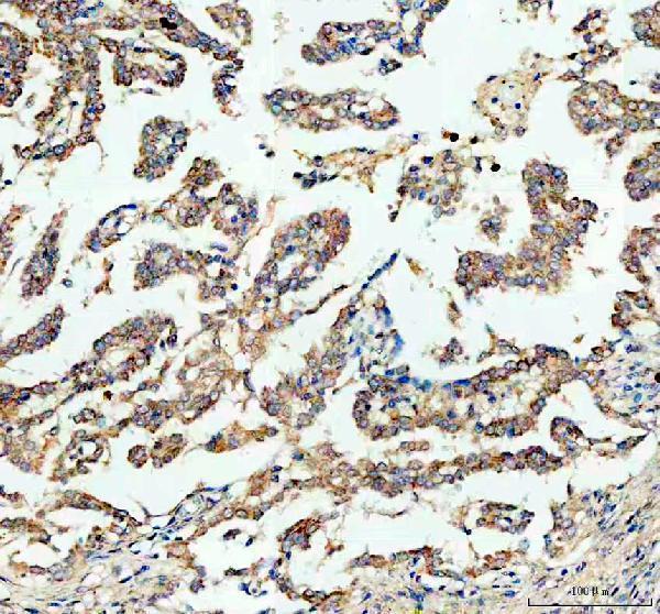 a00183 bax primary antibodies ihc testing 2
