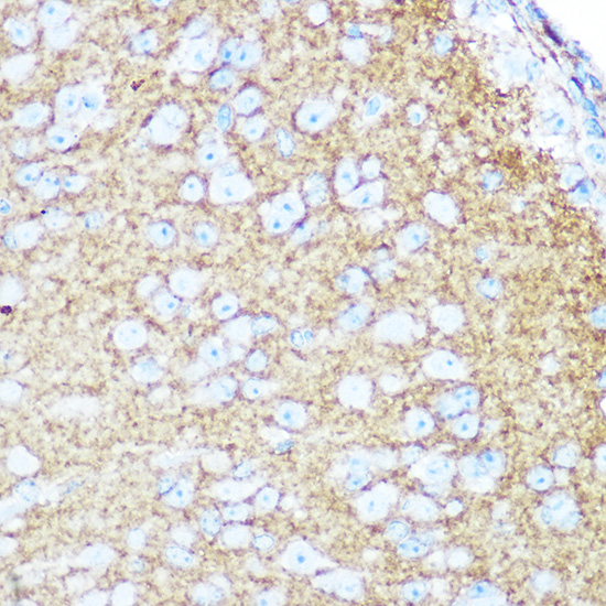 a00184 2 ncam1 primary antiboties ihc testing 3
