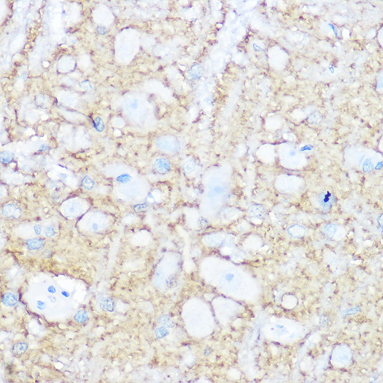 a00184 2 ncam1 primary antiboties ihc testing 4