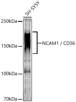 a00184 2 ncam1 primary antiboties wb testing 2