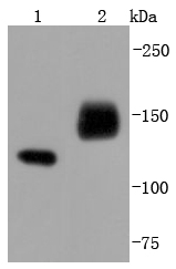Western blot analysis of NCAM on different lysates using anti-NCAM antibody at 1/1,000 dilution