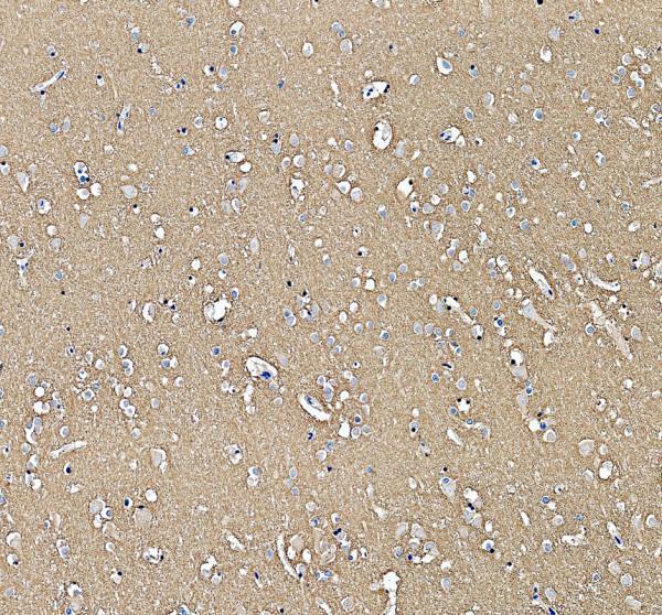 a00184 ncam1 primary antibodies ihc testing 1