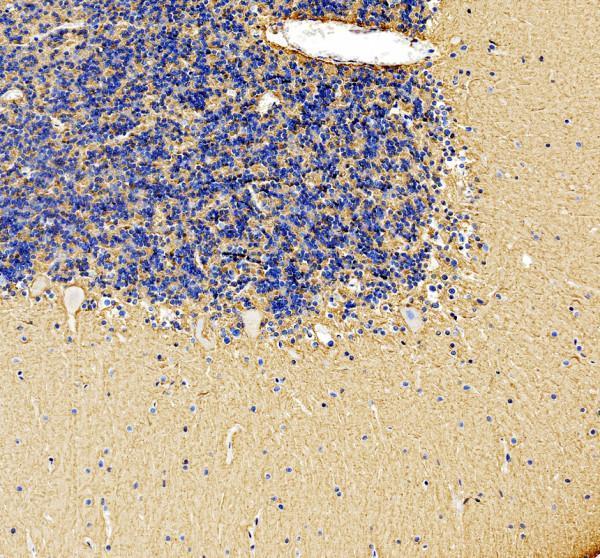 a00184 ncam1 primary antibodies ihc testing 2
