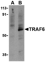 Western blot analysis of TRAF6 in PC-3 cell lysates with TRAF6 antibody at 1 μg/mL in the presence (A) or absence (B) of 1 μg blocking peptide