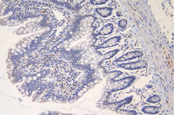  IHC analysis of TRAF6 using anti-TRAF6 antibody (A00185)