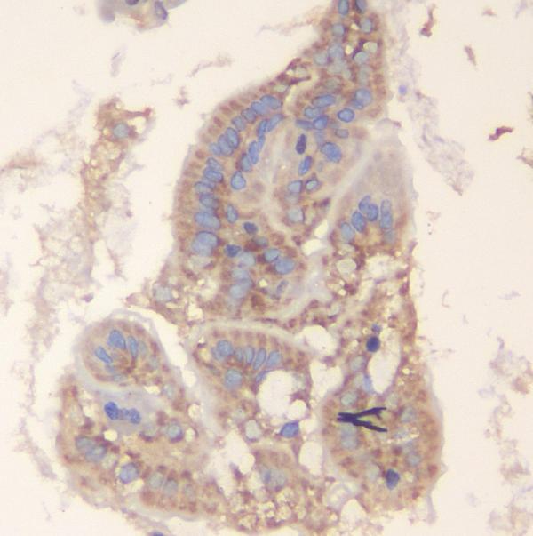  IHC analysis of TRAF6 using anti-TRAF6 antibody (A00185)