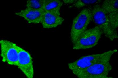 a00187 1 muc1 primary antiboties icc testing 2