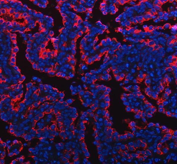 a00187 2 muc1 primary antibodies if testing 1