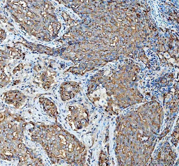a00187 2 muc1 primary antibodies ihc testing 2