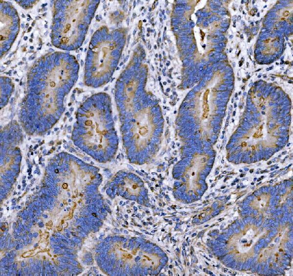 a00187 3 muc1 primary antibodies ihc testing 1