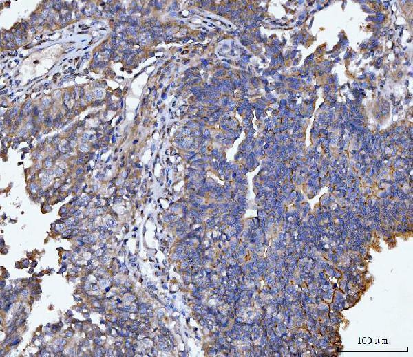 a00187 4 muc1 primary antibodies ihc testing 1