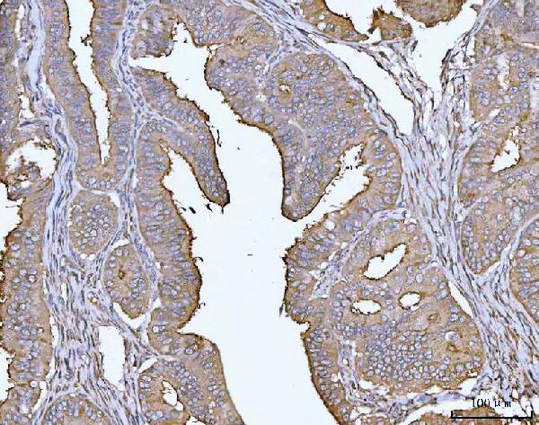 a00187 4 muc1 primary antibodies ihc testing 2