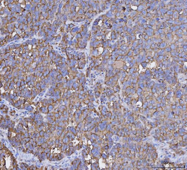 a00187 4 muc1 primary antibodies ihc testing 3