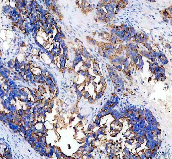 a00187 muc1 primary antibodies ihc testing 2